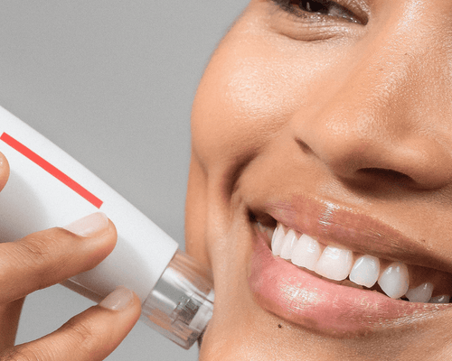 Microneedling & Microdermabrasion