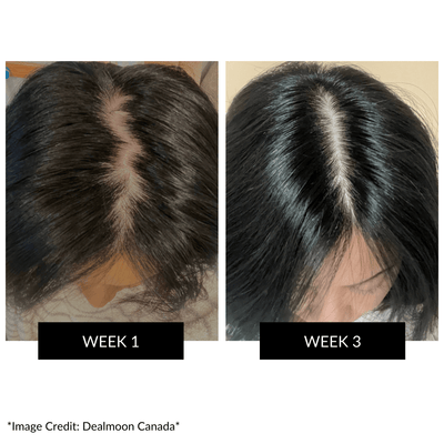 Hongmall. CurrentBody Skin LED Hair Growth Helmet S/M