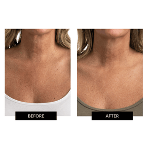 CurrentBody Skin LED Neck & Décolletage Perfector Offer