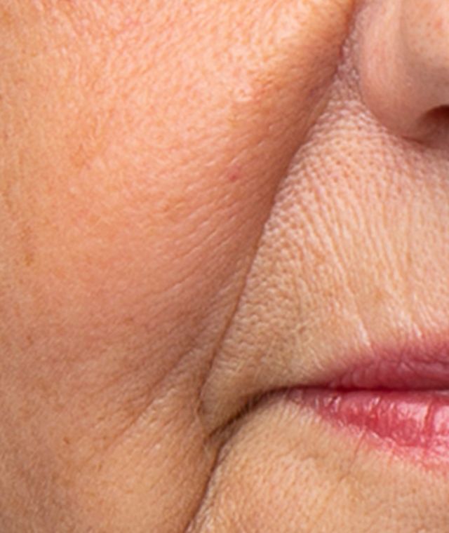 カレントボディ Dermalux Flex MD Dermalux Flex MD LED Light Therapy Device | CurrentBody USA