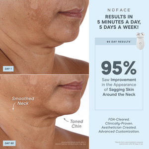 NuFACE TRINITY+ Wrinkle Reducer Attachment