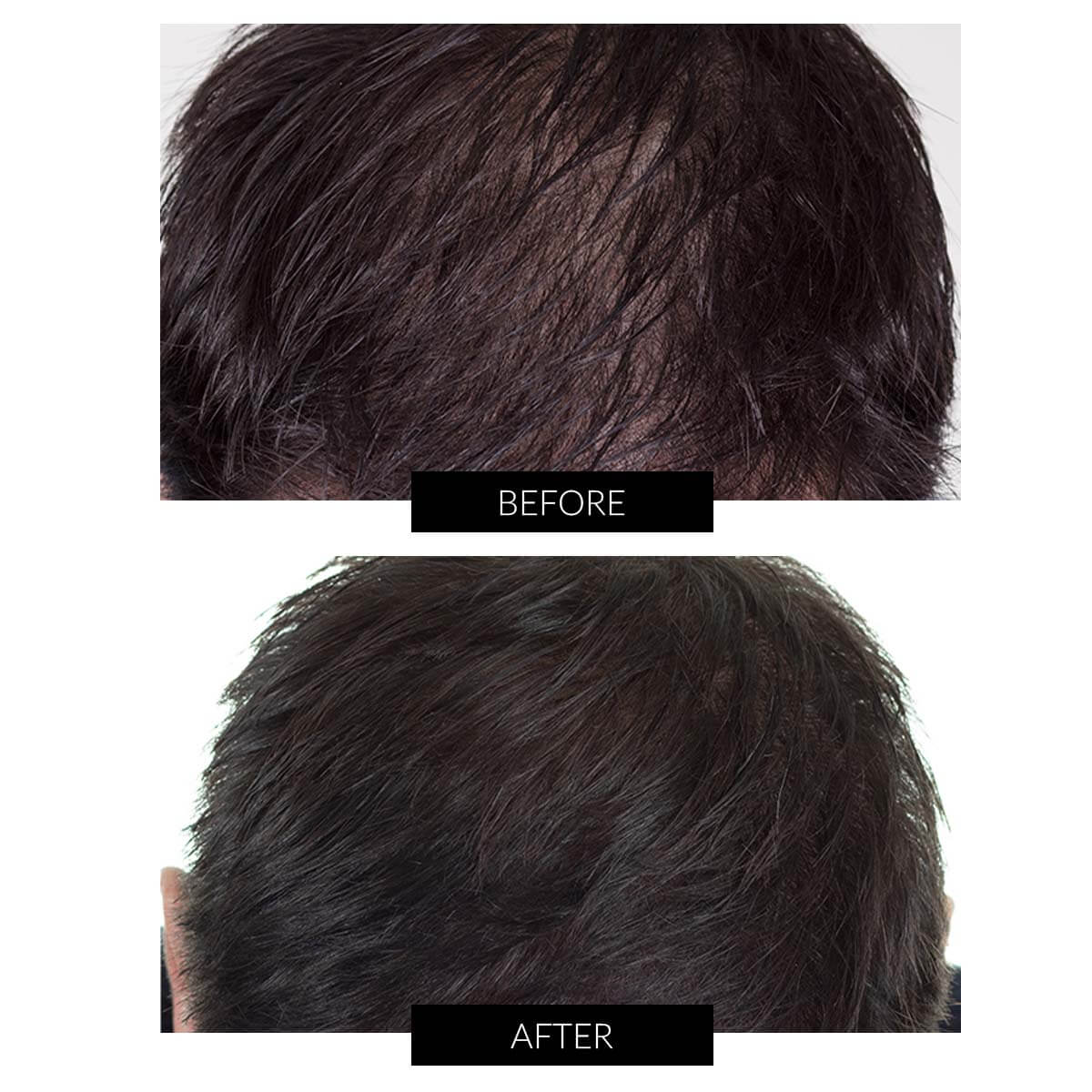 CapillusPro Hair Regrowth Laser Cap | CurrentBody US