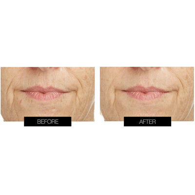 CurrentBody Skin Lip Hydrating & Anti-Aging Bundle
