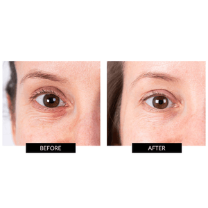 CurrentBody Skin Complete Eye Anti-Aging LED set
